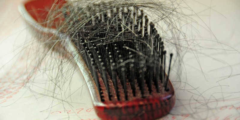 Haarverlies bij mannen
